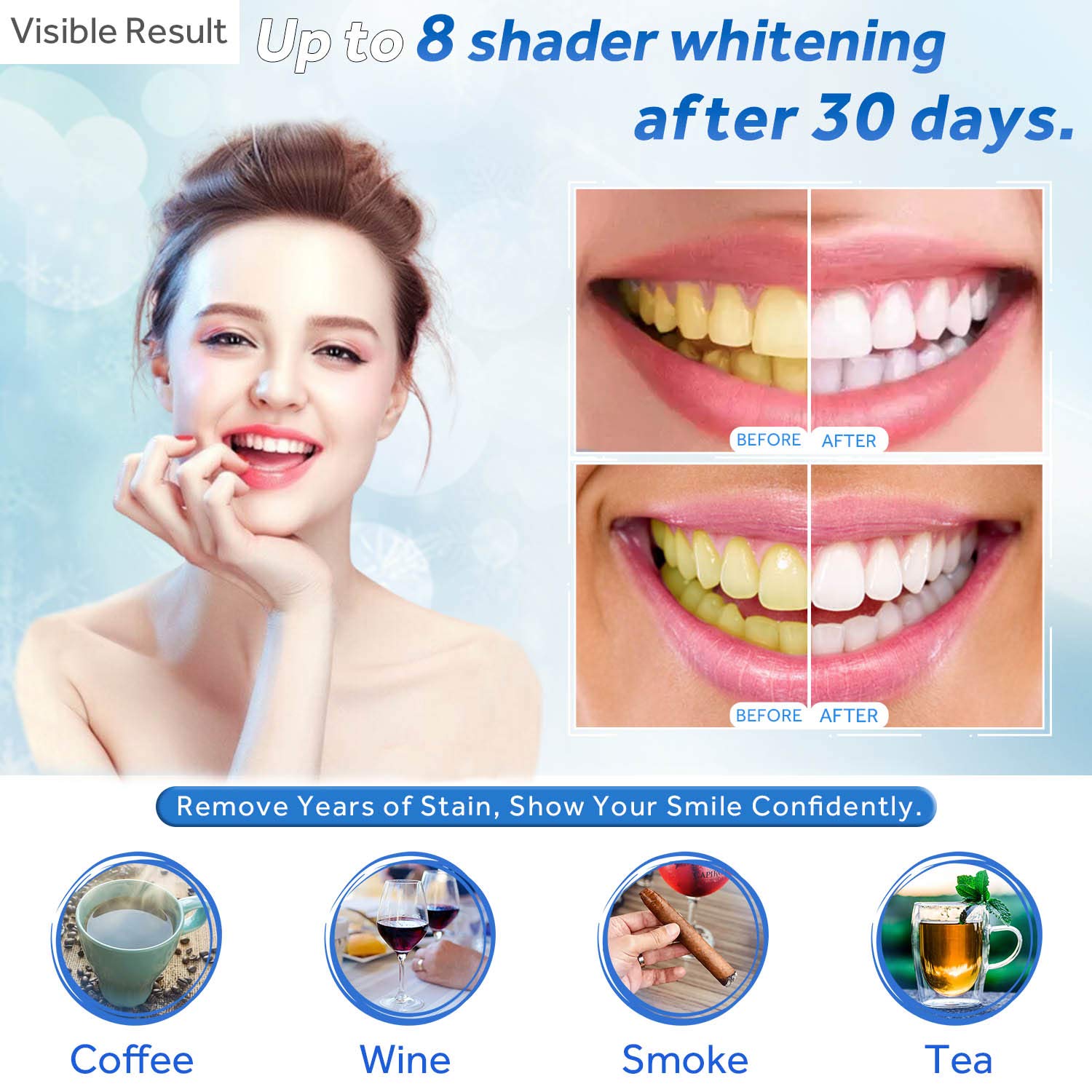 Tanden Whitening Gel Refill Sp - Teeth Whitening Near Me recensie en prijs