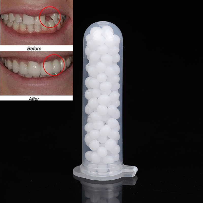 【K】1 doos tijdelijke tandrepar - Teeth Whitening Kit recensie en prijs