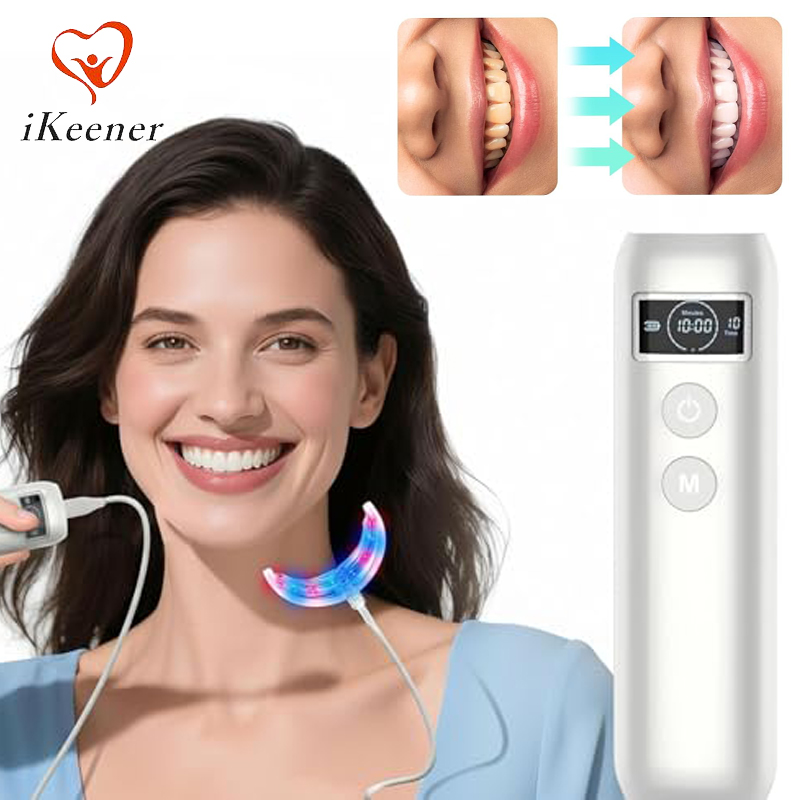 Tandenbleek-accelerator met 16 - Teeth Whitening Kit recensie en prijs